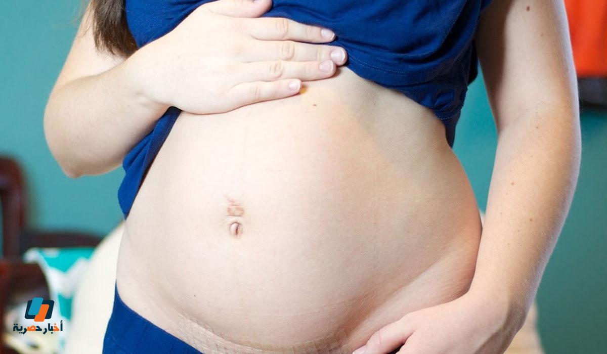 متى يرجع شكل البطن الطبيعي بعد الولادة الطبيعية أو القيصرية